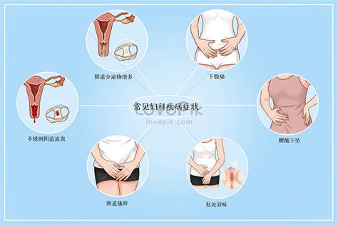 婦科病|認識婦科疾病：有哪些疾病、症狀、原因以及如何進行檢查